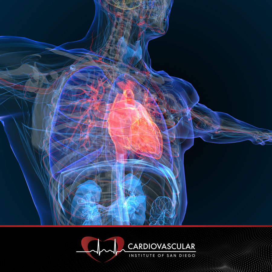 Cardiovascular Institute of San Diego | Best Cardiologist